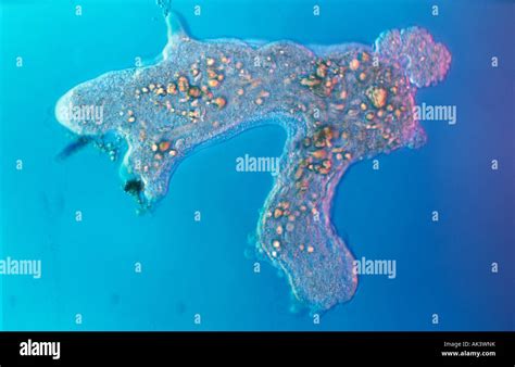  Chaos Amoeba:  Can This Single-Celled Creature Masterfully Sculpt Its Own Form While Navigating Its Microscopic World?